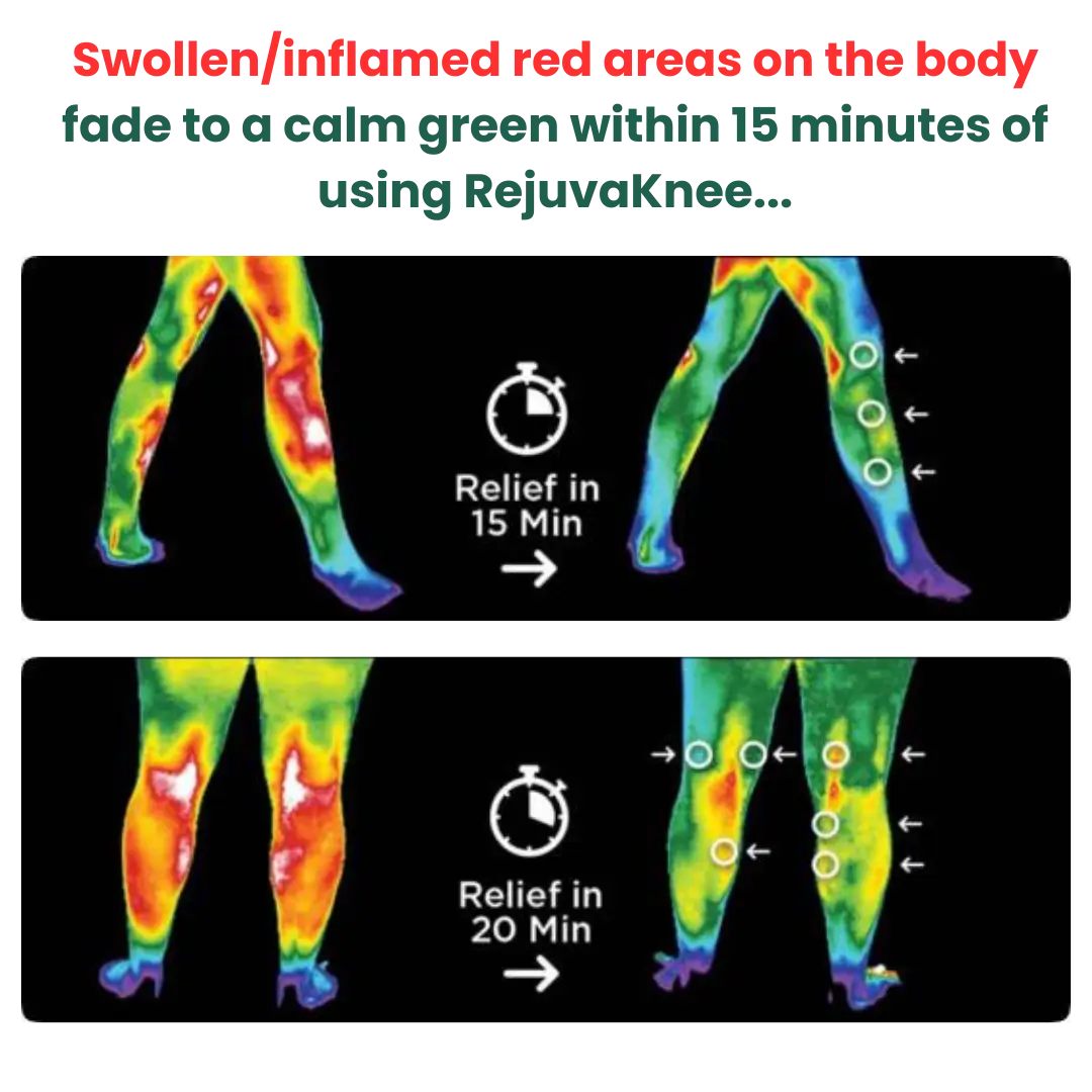 RejuvaKnee "Triple Method" Massager - Image 8